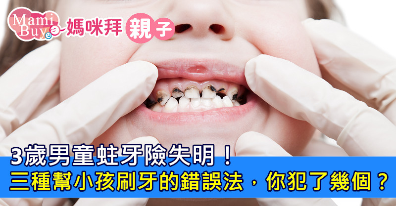 3歲男童蛀牙險失明!三種幫小孩刷牙的錯誤法,你犯了幾個?