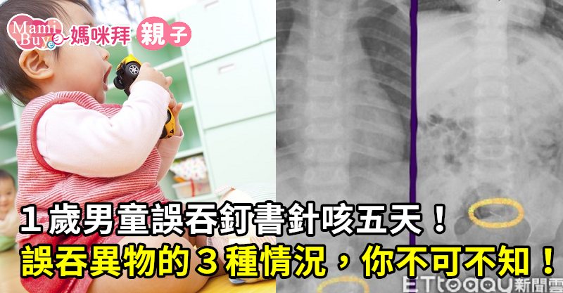 誤吞異物