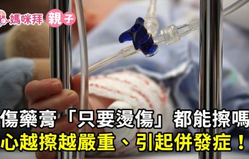 燙傷藥膏 只要燙傷 都能擦嗎 小心越擦越嚴重 引起併發症 Mamibuy編輯部 媽咪拜mamibuy